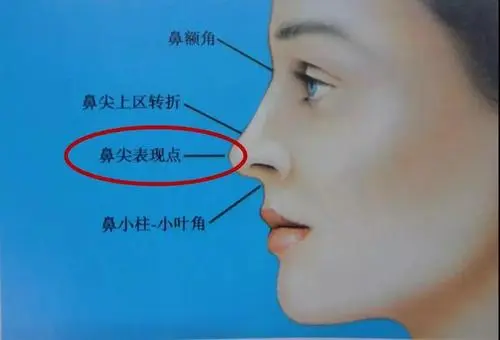 鼻翼缩小手术是危险吗？