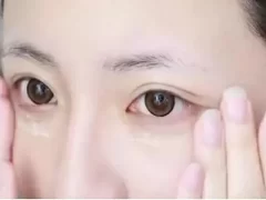 如何去除眼部的细纹?——眼部护理方法-女人美