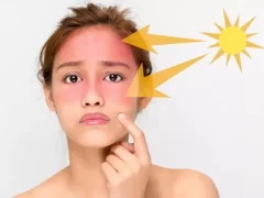 皮肤晒伤发红怎么修复?-女人美