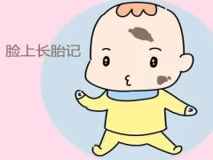 胎记治疗一般多少钱?-女人美