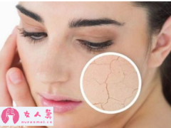 皮肤干燥起皮怎么办？该如何保养-女人美