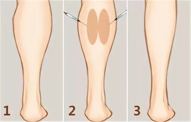 怎样瘦大腿和小腿