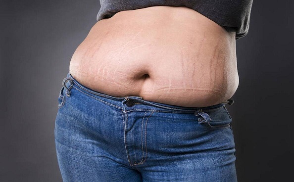 为什么有些人吃得很少却容易发胖?