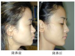 医美项目都有哪些?-女人美