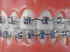 牙齿整形医院:如何精准避坑,选对“人生牙医”-女人美