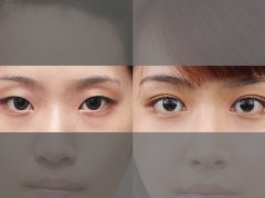 眼部整形医院排名前十-女人美